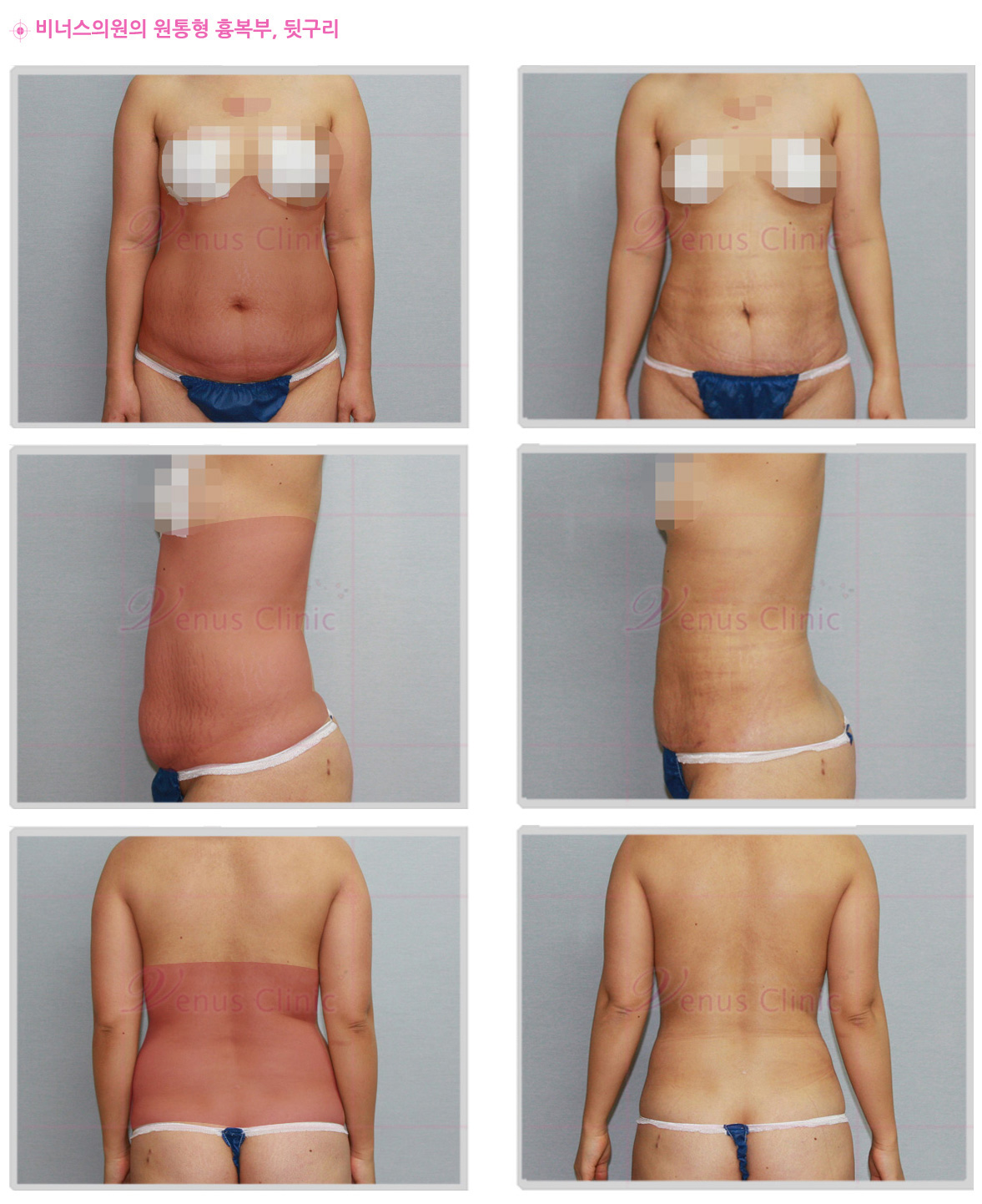 maxp_abdomen_.jpg