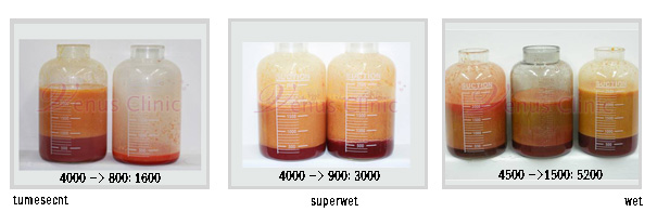 tumescent.jpg