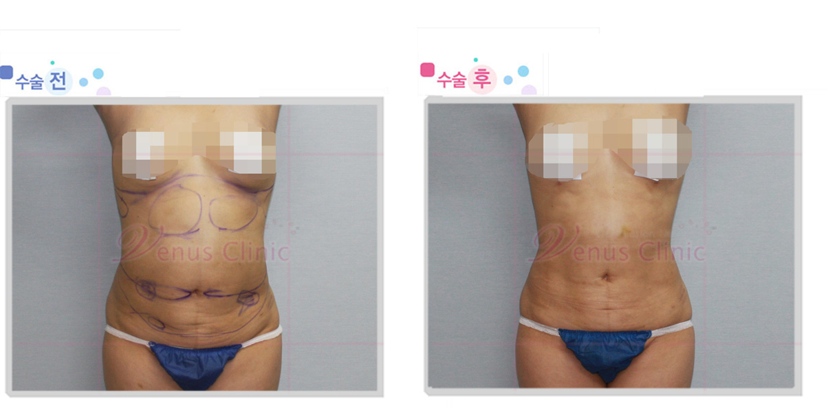 lipotrop.jpg