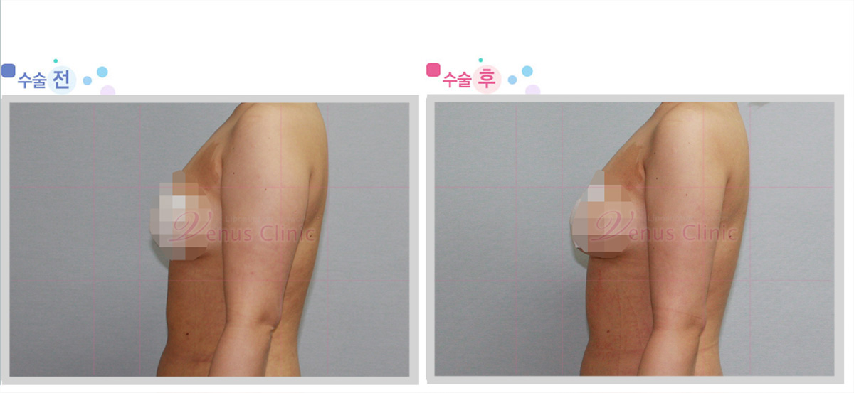 arm2.jpg arm2.jpg