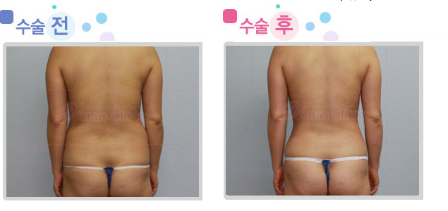 female_waist.jpg female_waist.jpg