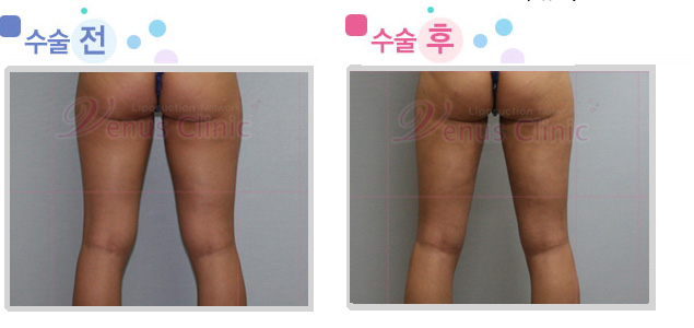 knees.jpg knees.jpg
