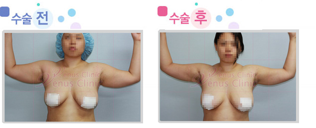 arm_01_1.jpg