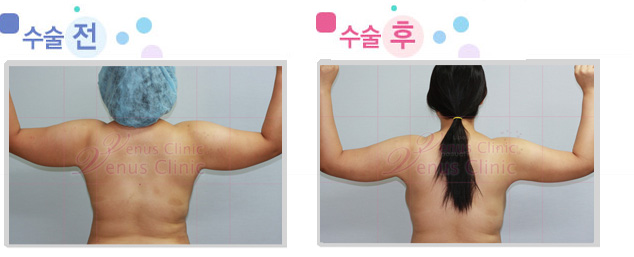 arm_01_2.jpg
