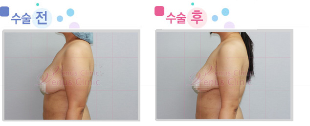 arm_01_3.jpg