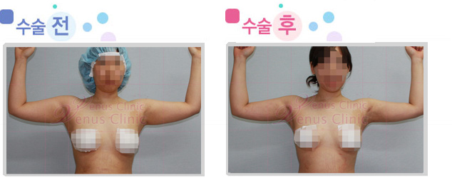 arm_02_1.jpg