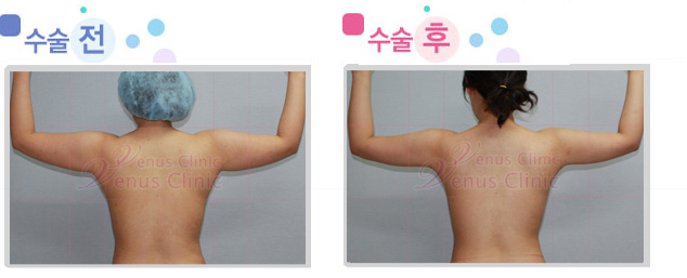 arm_02_2.jpg