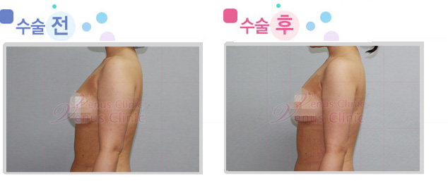 arm_02_3.jpg