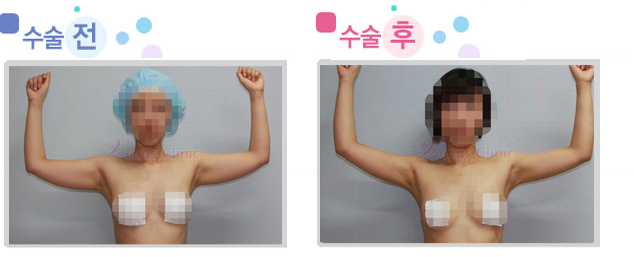arm_03_1.jpg