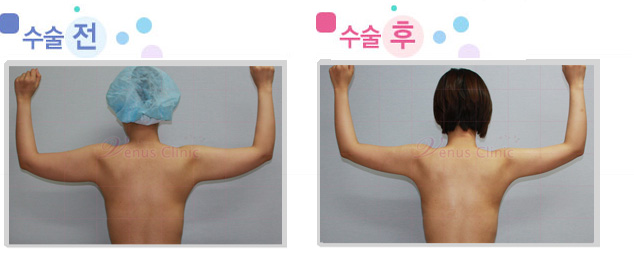 arm_03_2.jpg