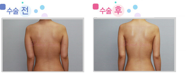 arm_03_3.jpg