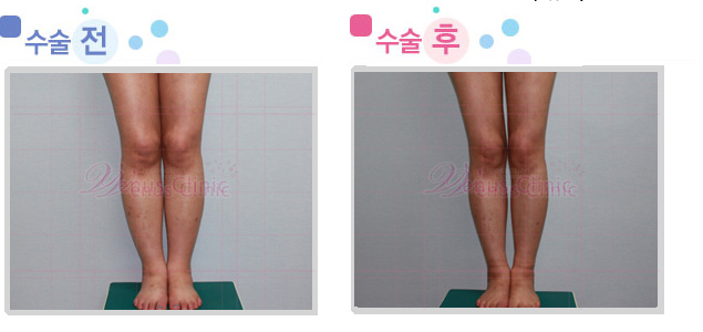 leg01_1.jpg