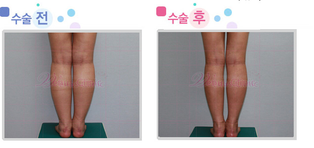 leg01_2.jpg