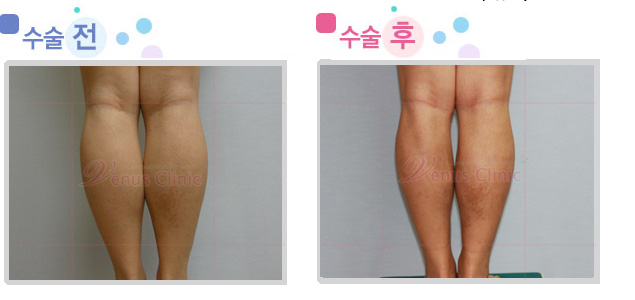 leg02_1.jpg