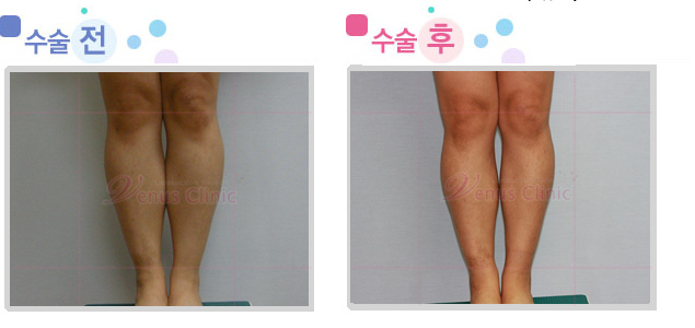 leg02_2.jpg