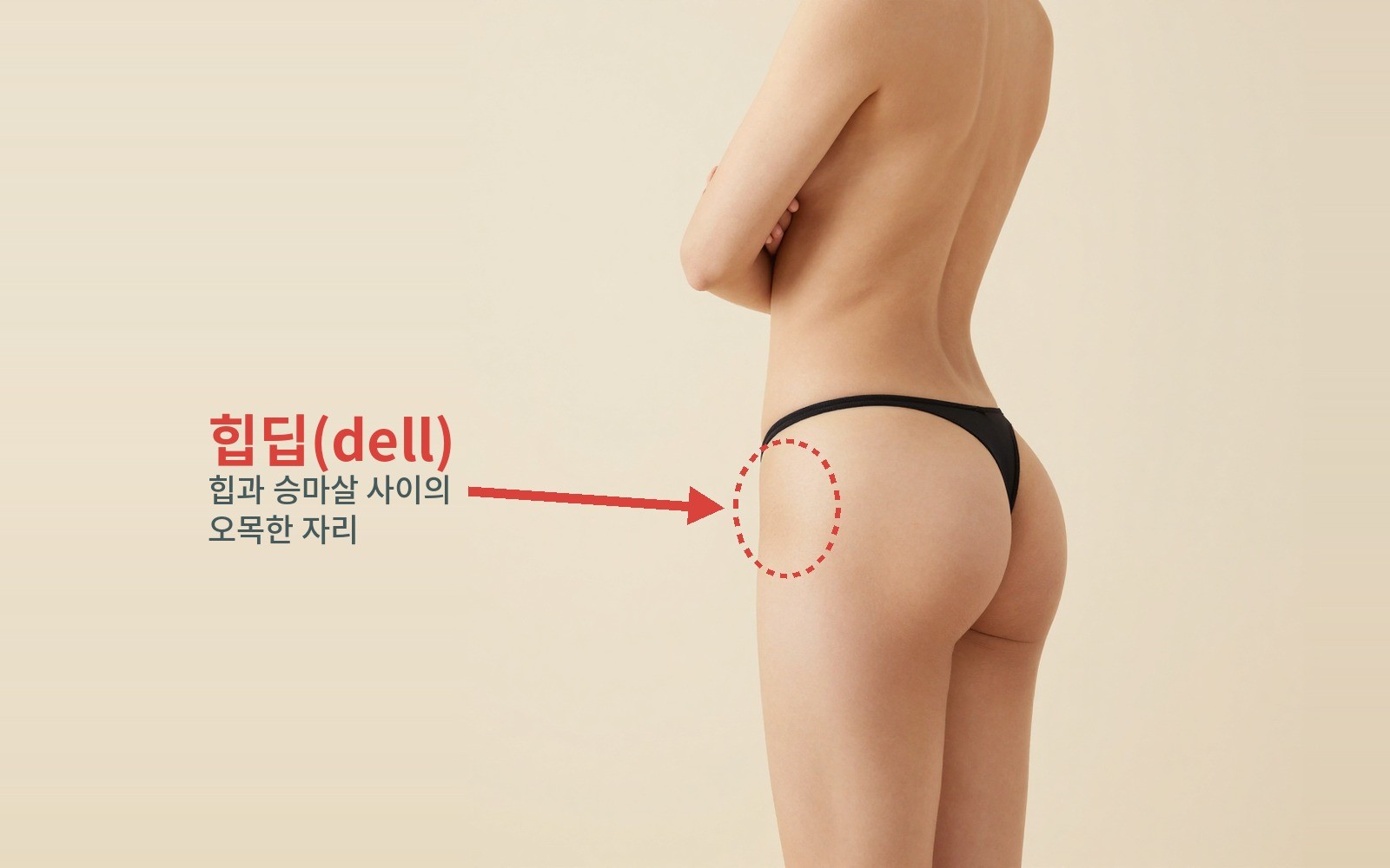 뒤쪽 비스듬한 각도에서 본 엉덩이 — 힙과 승마살 사이의 오목한 자리(힙딥, dell)를 화살표로 표시
