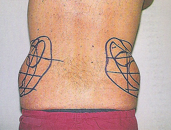 러브핸들 디자인 모습