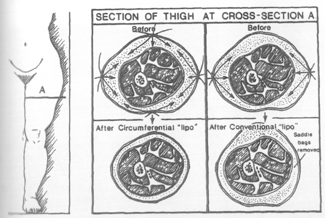 circum.jpg circum.jpg