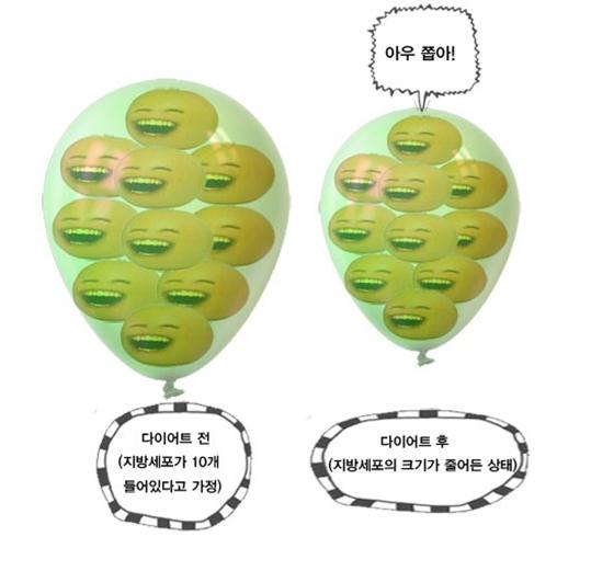 부천지방흡입,인천지방흡입,지방흡입과 다이어트차이