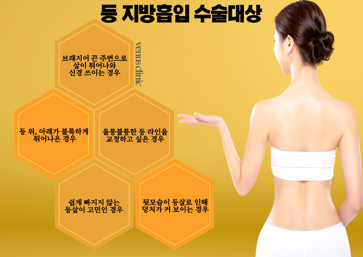 등지방흡입-002 (1).jpg