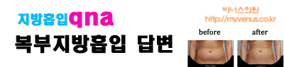 복부지방흡입답변.jpg