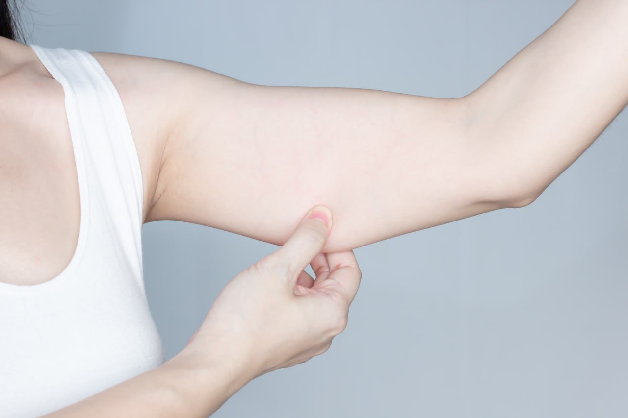 팔뚝 지방흡입 후 회복 요가 스트레칭 여성