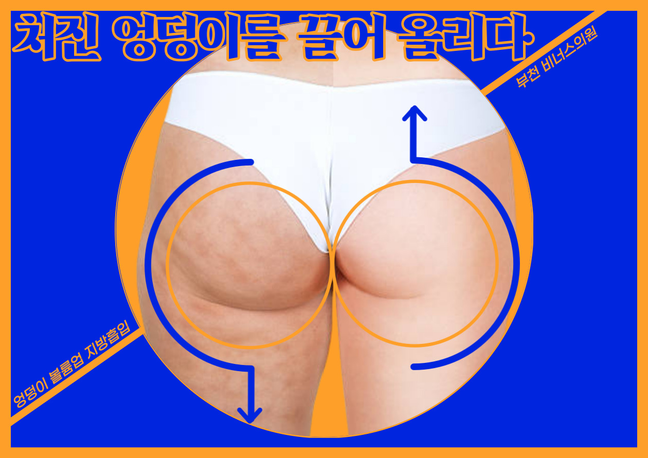 엉덩이볼륨업1.jpg
