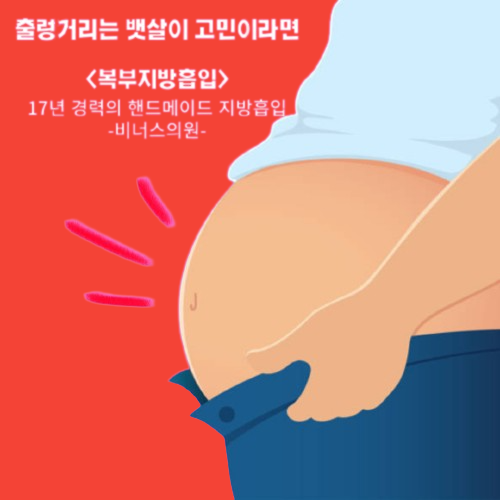 복부지방흡입