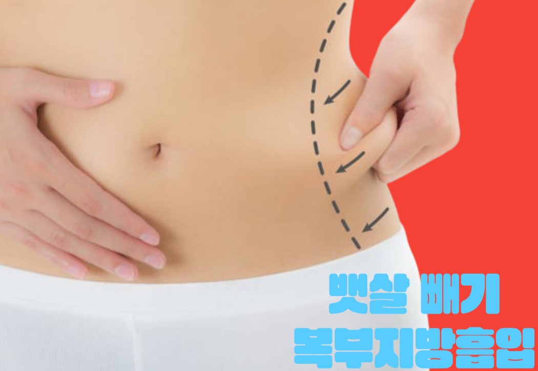 복부지방흡입대표사진