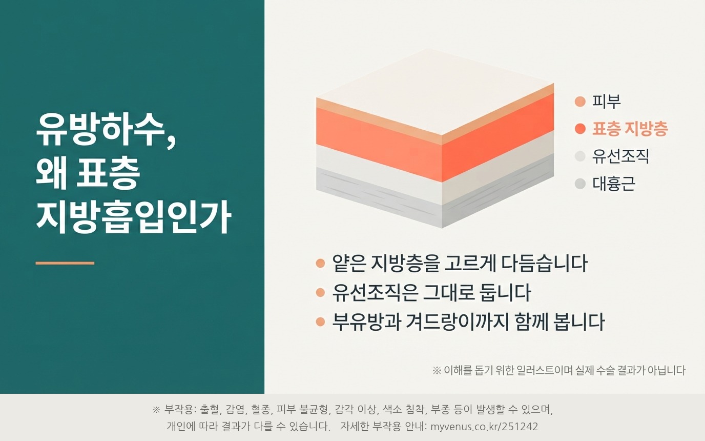 유방하수에 표층 지방흡입을 적용하는 원리 — 피부·표층 지방층·유선조직·대흉근 단면 일러스트