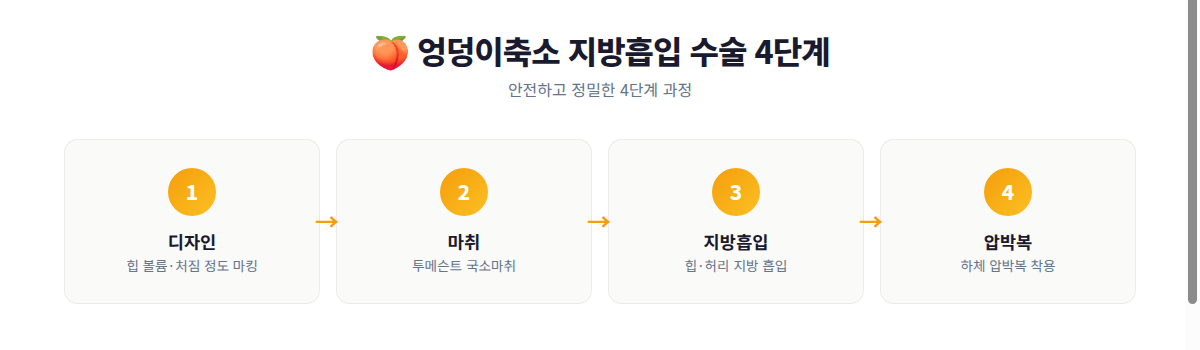 엉덩이 지방흡입 수술 4단계 과정 인포그래픽