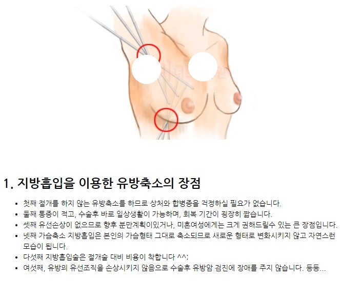 가슴지방흡입 장점.jpg