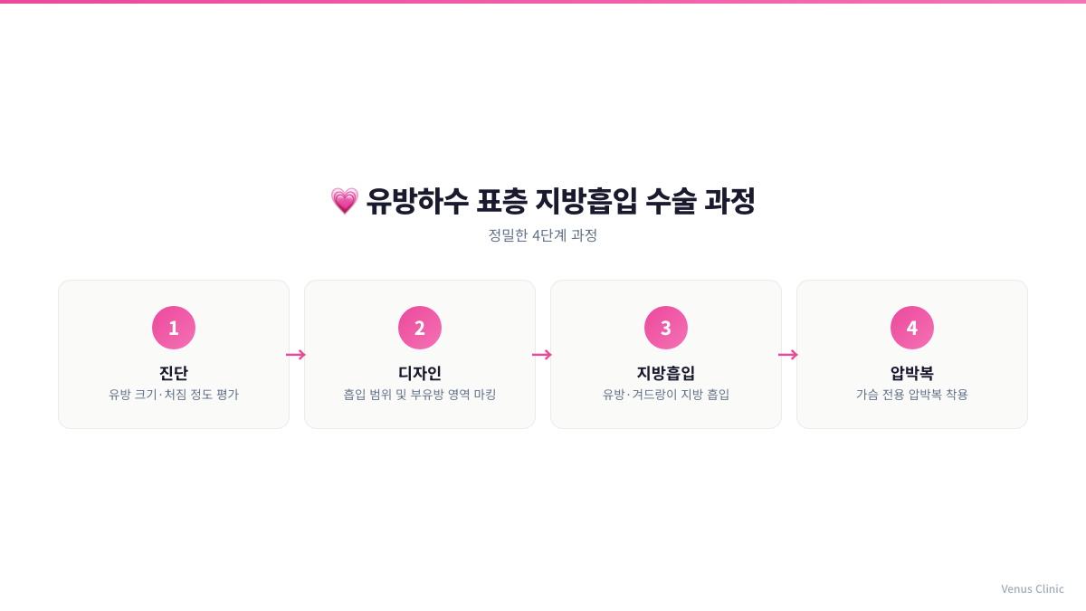 유방하수 표층 지방흡입 수술 과정 4단계 인포그래픽