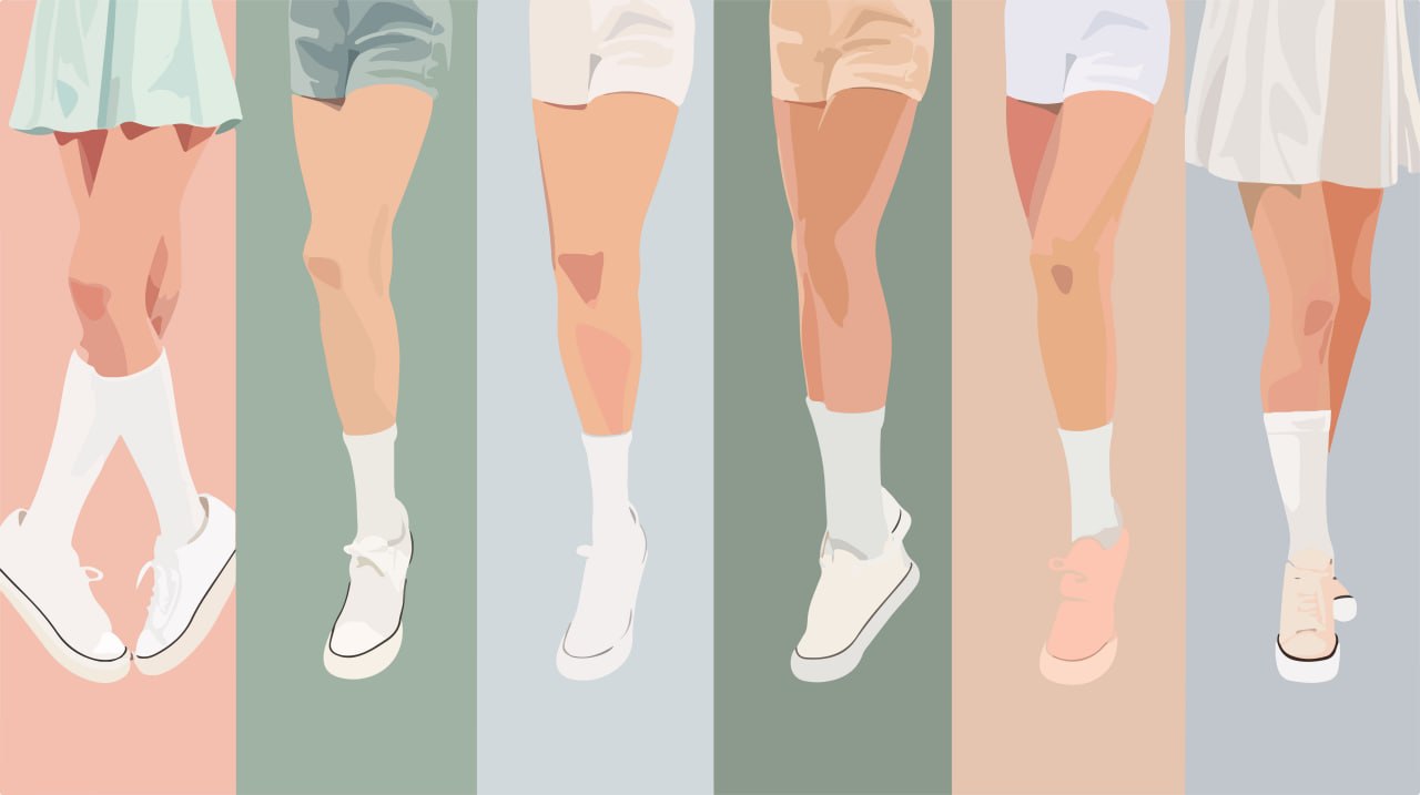 허벅지 지방흡입 이식 수술 설명 이미지 비너스의원