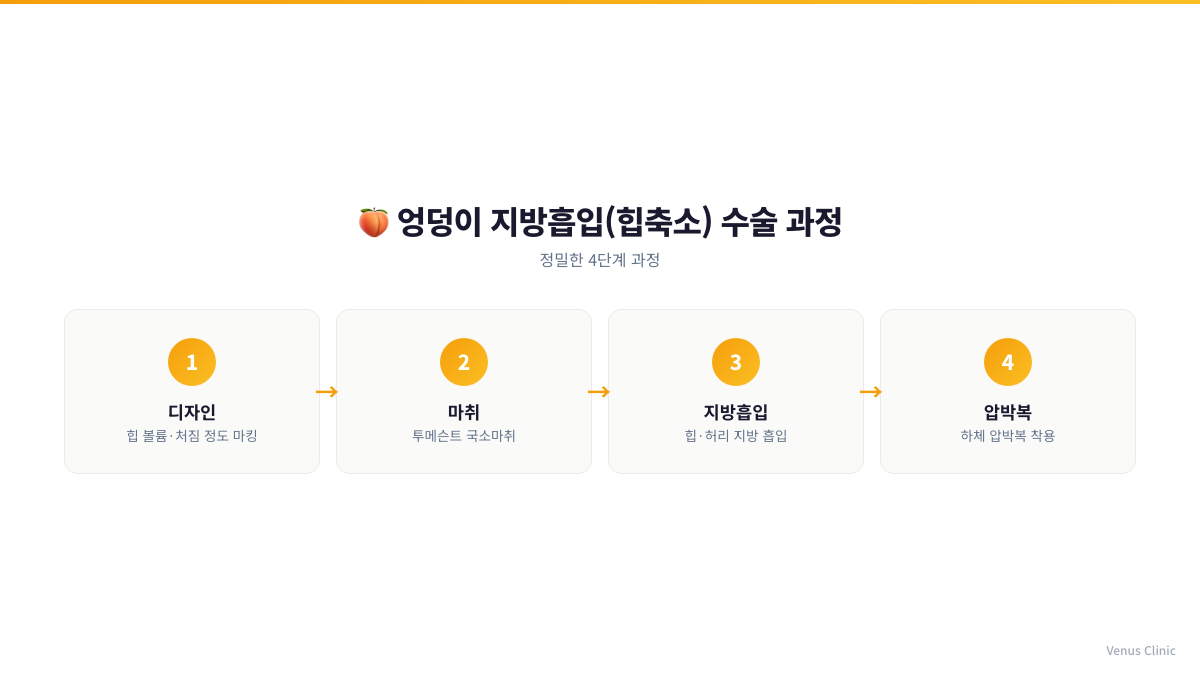 엉덩이 지방흡입 수술 과정 4단계 인포그래픽 비너스의원