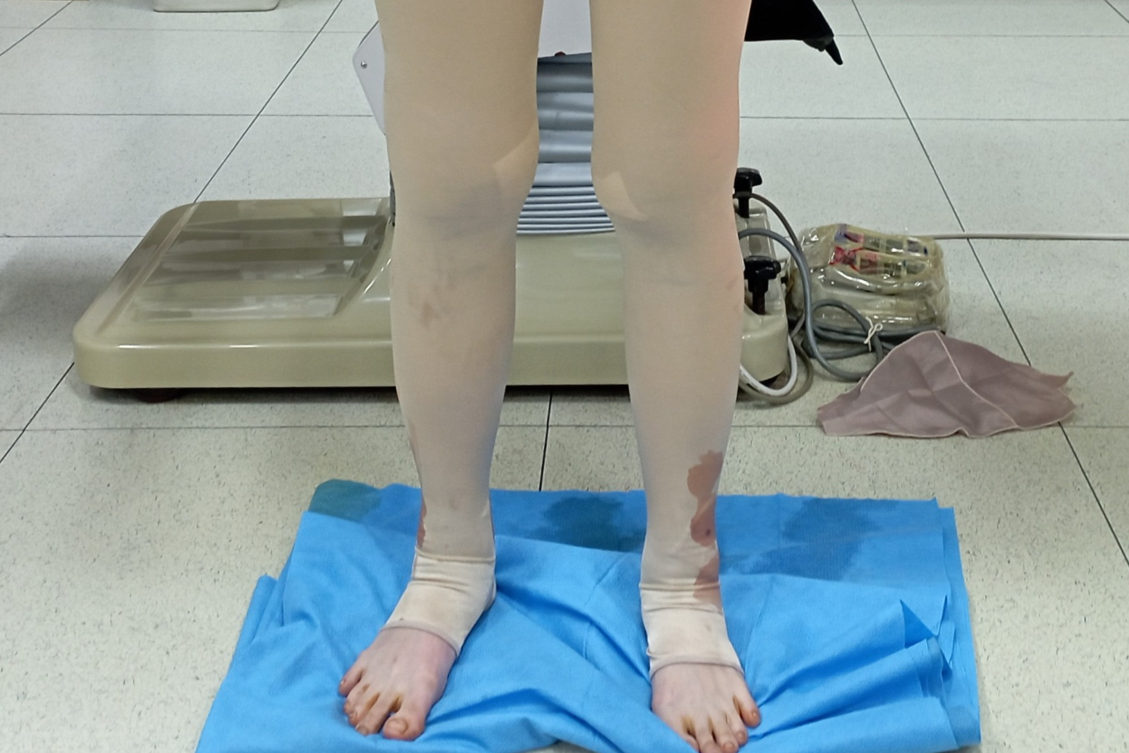 종아리 지방흡입 수술후 멍 부기 관리 압박복 .jpg