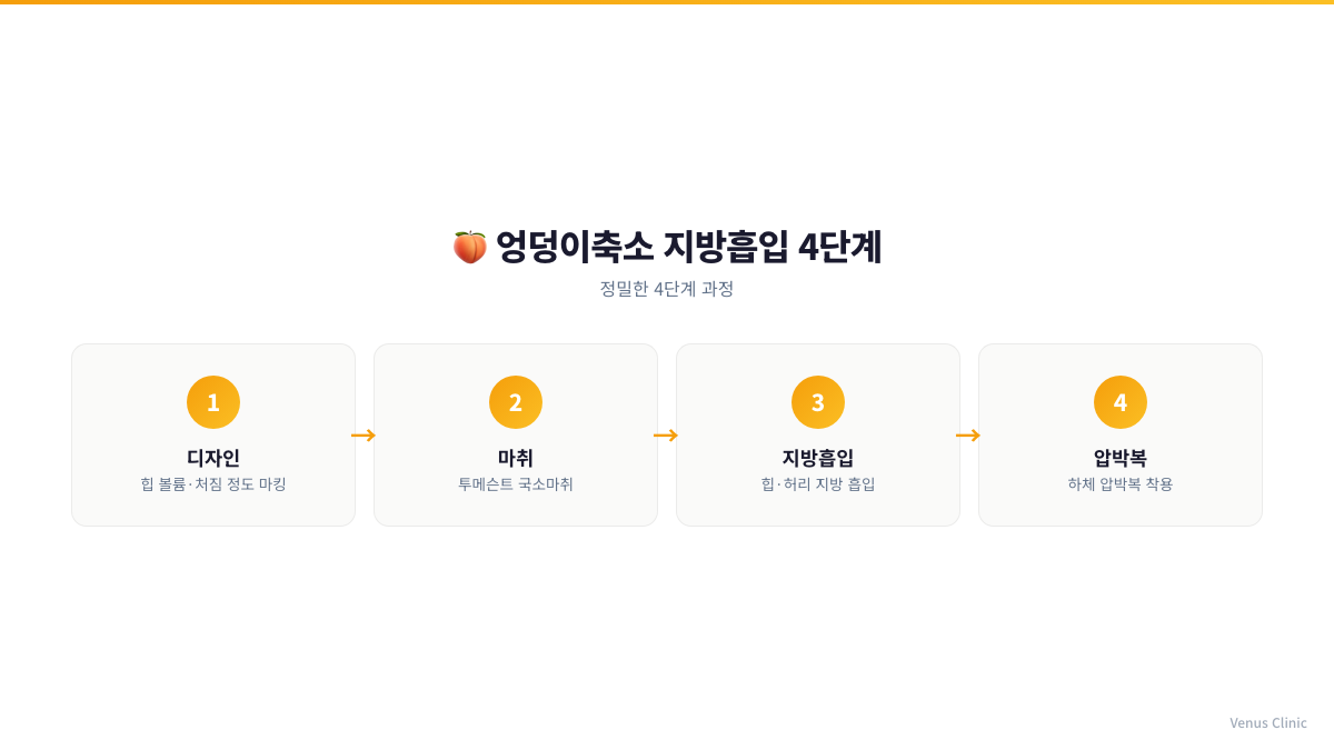 엉덩이축소 지방흡입 4단계 인포그래픽 — 디자인, 마취, 지방흡입, 압박복