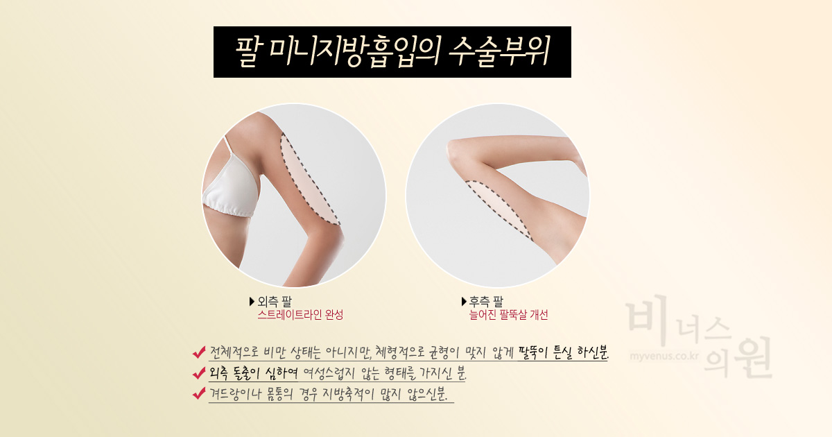팔뚝 지방흡입 미니 수술 회복 비너스의원