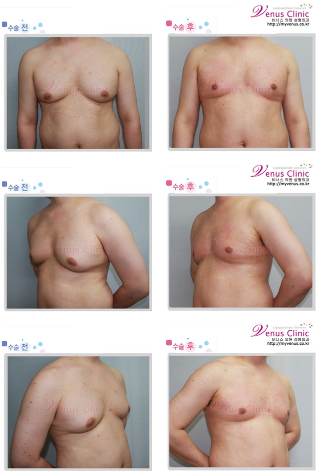 myvenus_co_kr_20110715_112226.jpg