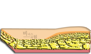 지방2.jpg