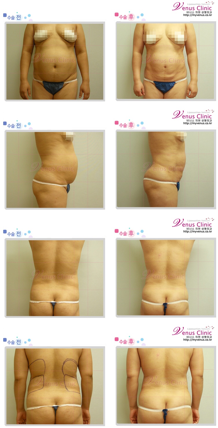 myvenus_co_kr_20110720_115533.jpg