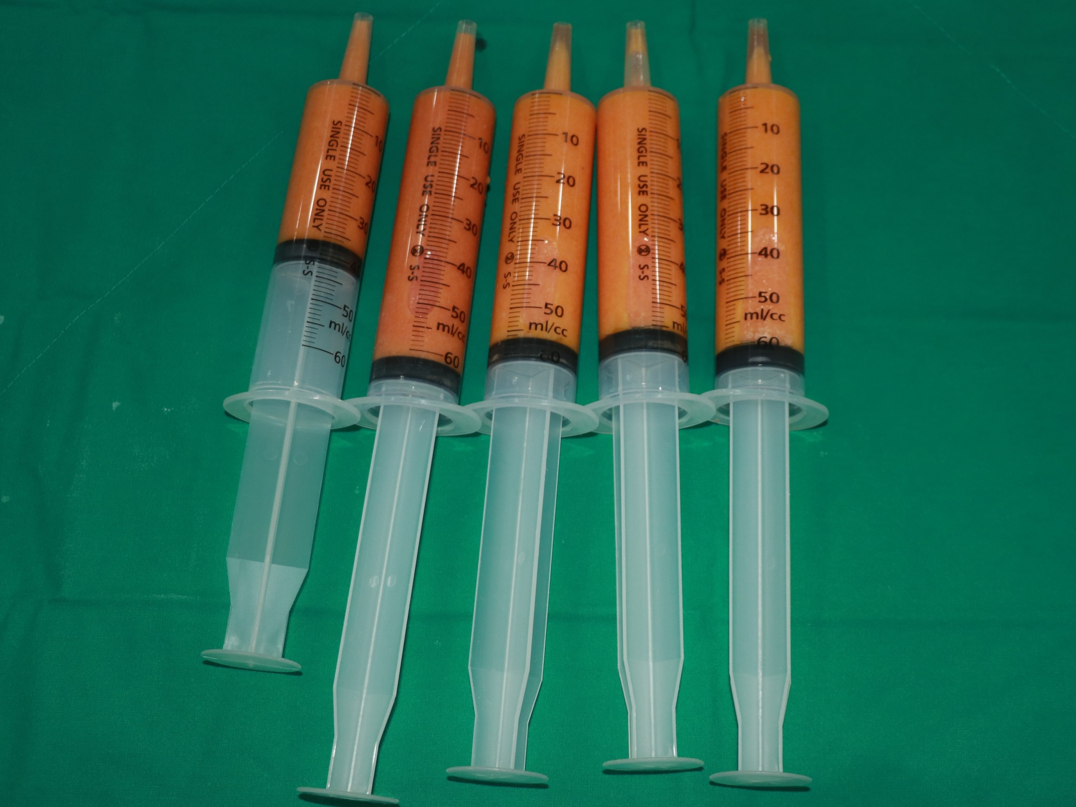 엉덩이 주름 처짐 힙업 지방이식.jpg