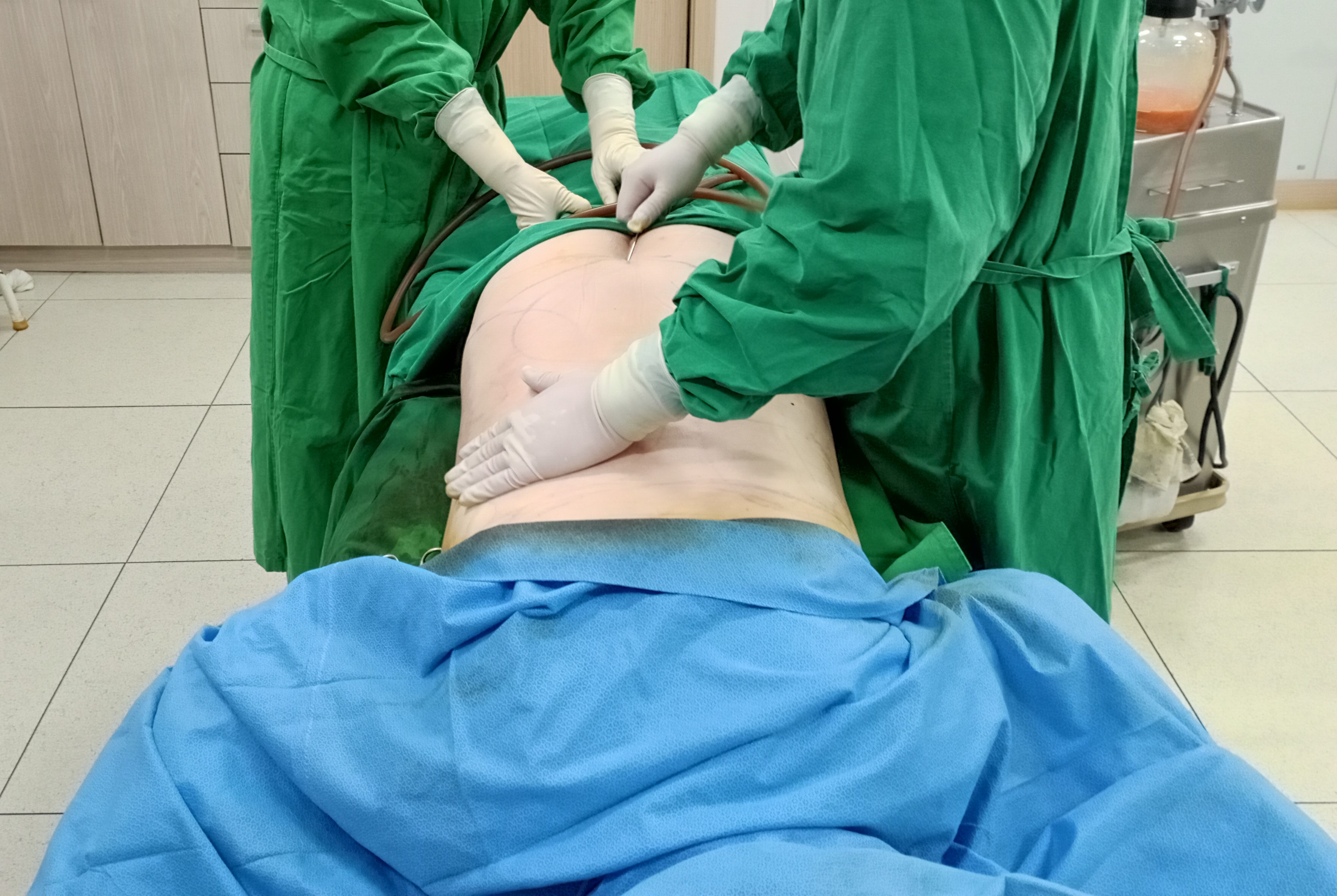 부천 복부지방흡입.jpg