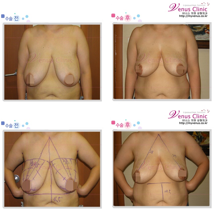 myvenus_co_kr_20110722_115145.jpg