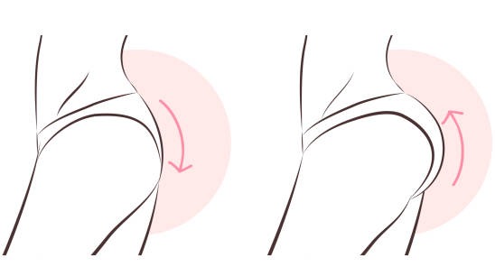 힙업 엉덩이 볼륨 처진엉덩이 엉덩이뽕 엉덩이지방흡입 엉덩이지방이식 엉덩이주사 엉뽕 .jpg