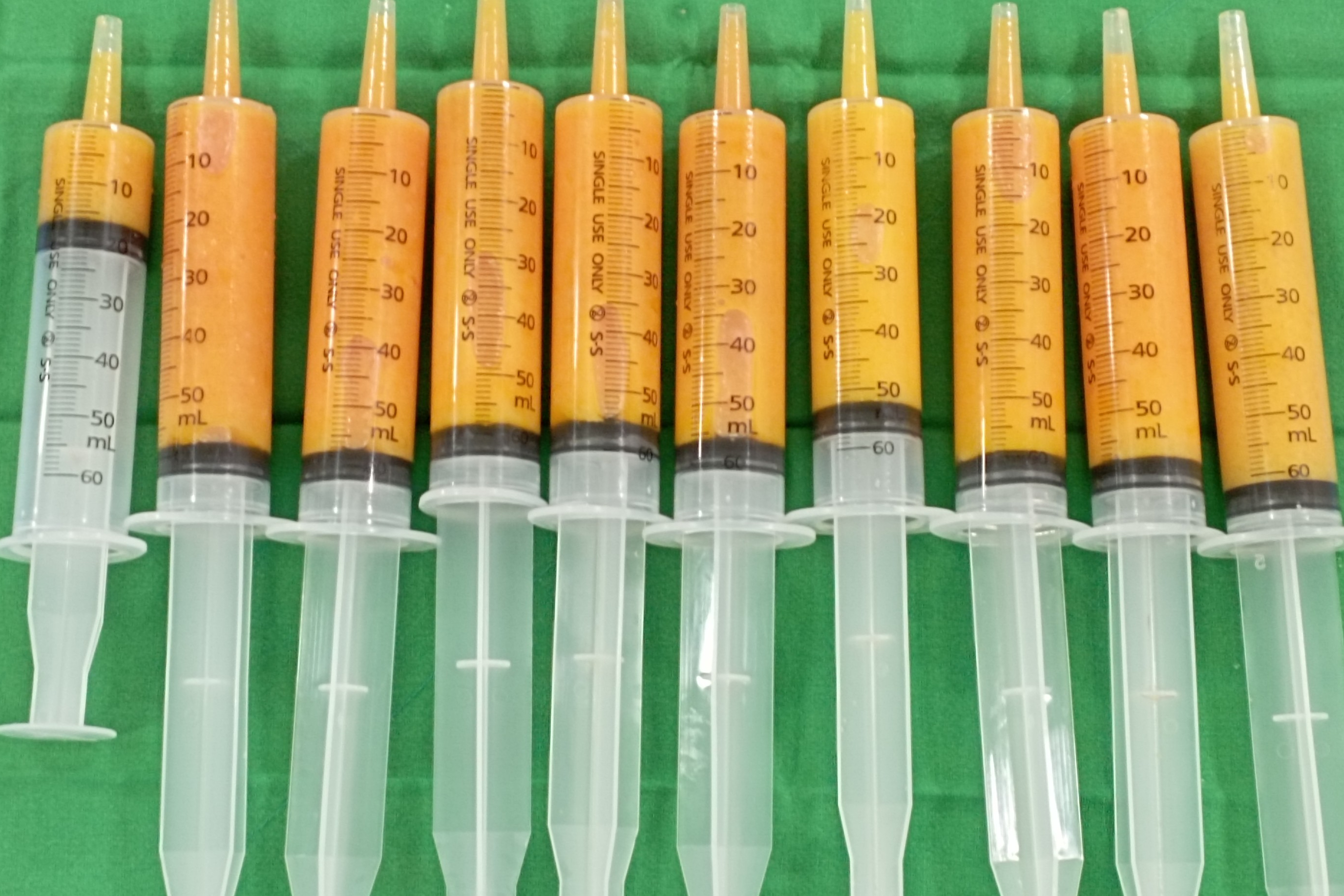 엉덩이지방이식 엉덩이지방이식부작용 엉덩이자가지방이식 엉덩이이식 엉덩이볼륨 엉덩이주름 힙업지방이식 엉덩이볼륨지방이식.jpg