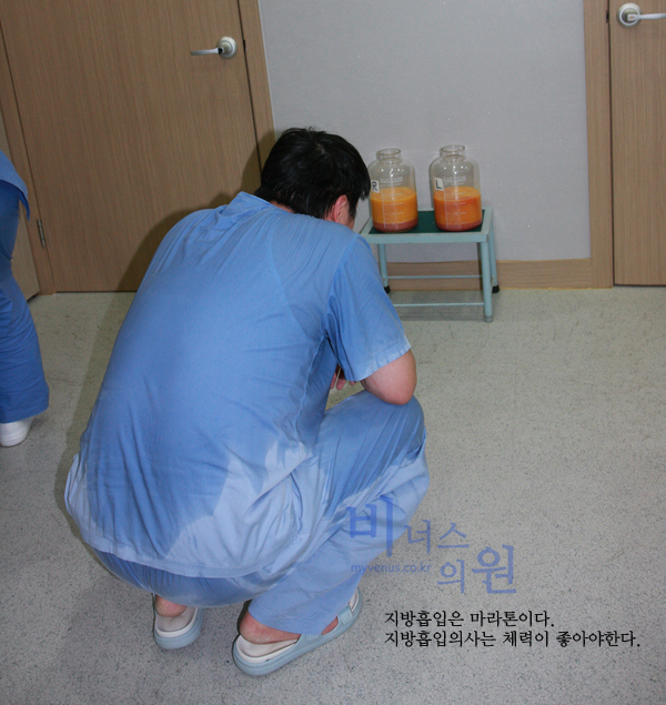 지방흡입 (ㅓ76).jpg