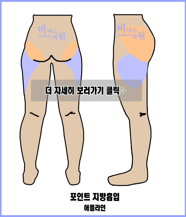 허벅지4.jpg