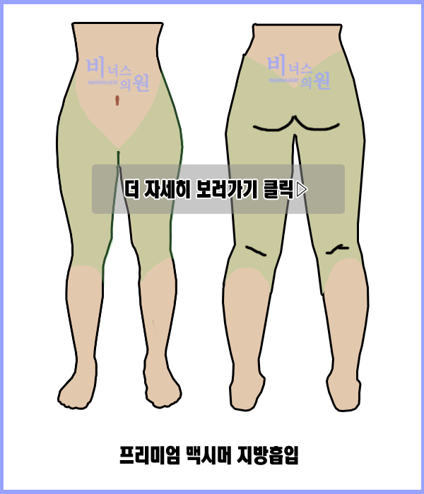 허벅지1.jpg