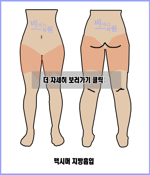 허벅지2.jpg